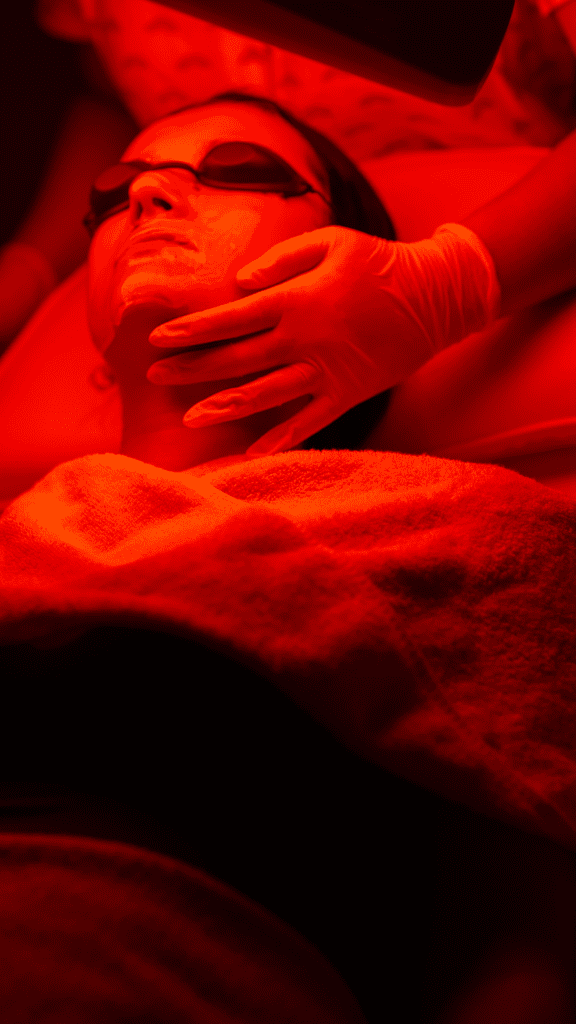 iCRYO’s Red Light Therapy Treatment - Red Light Therapy Before and After Results